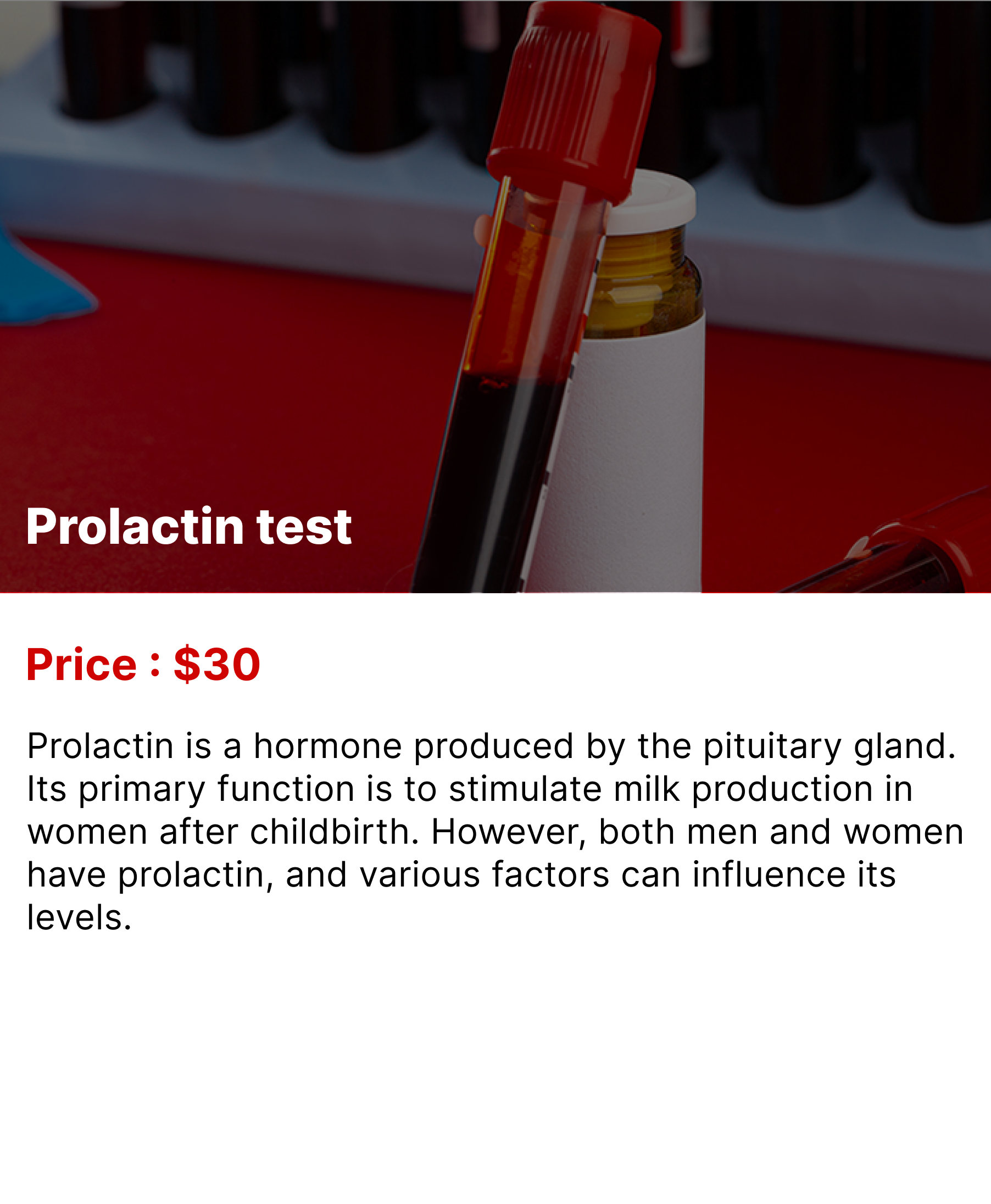 Prolactin