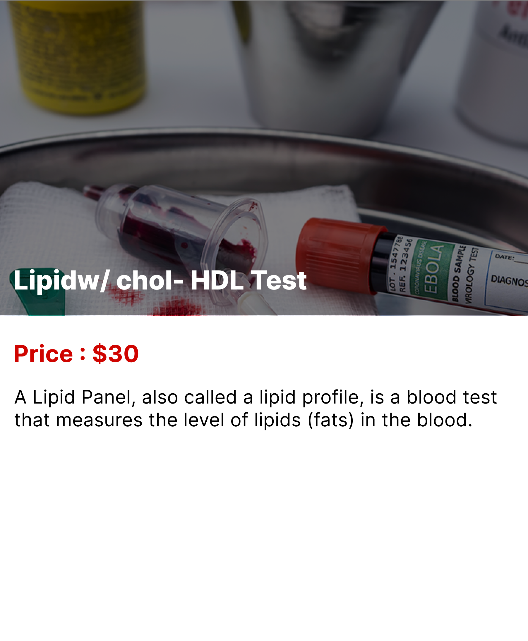 Lipidw/ Chol-HDL