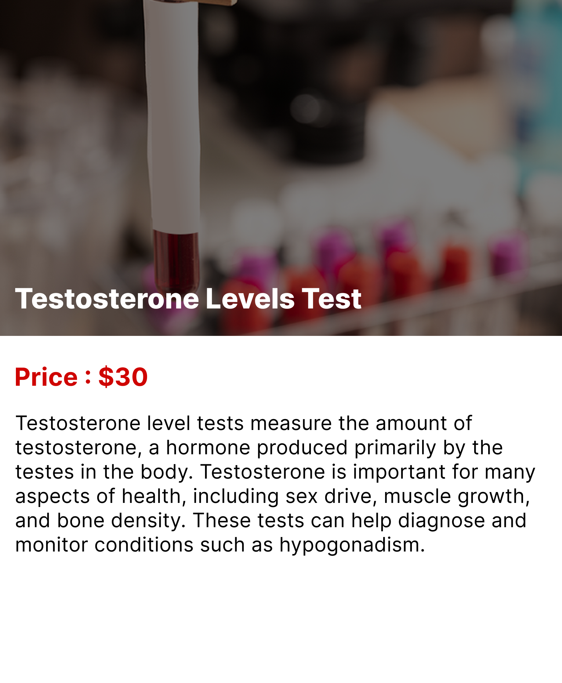 Testosterone Levels