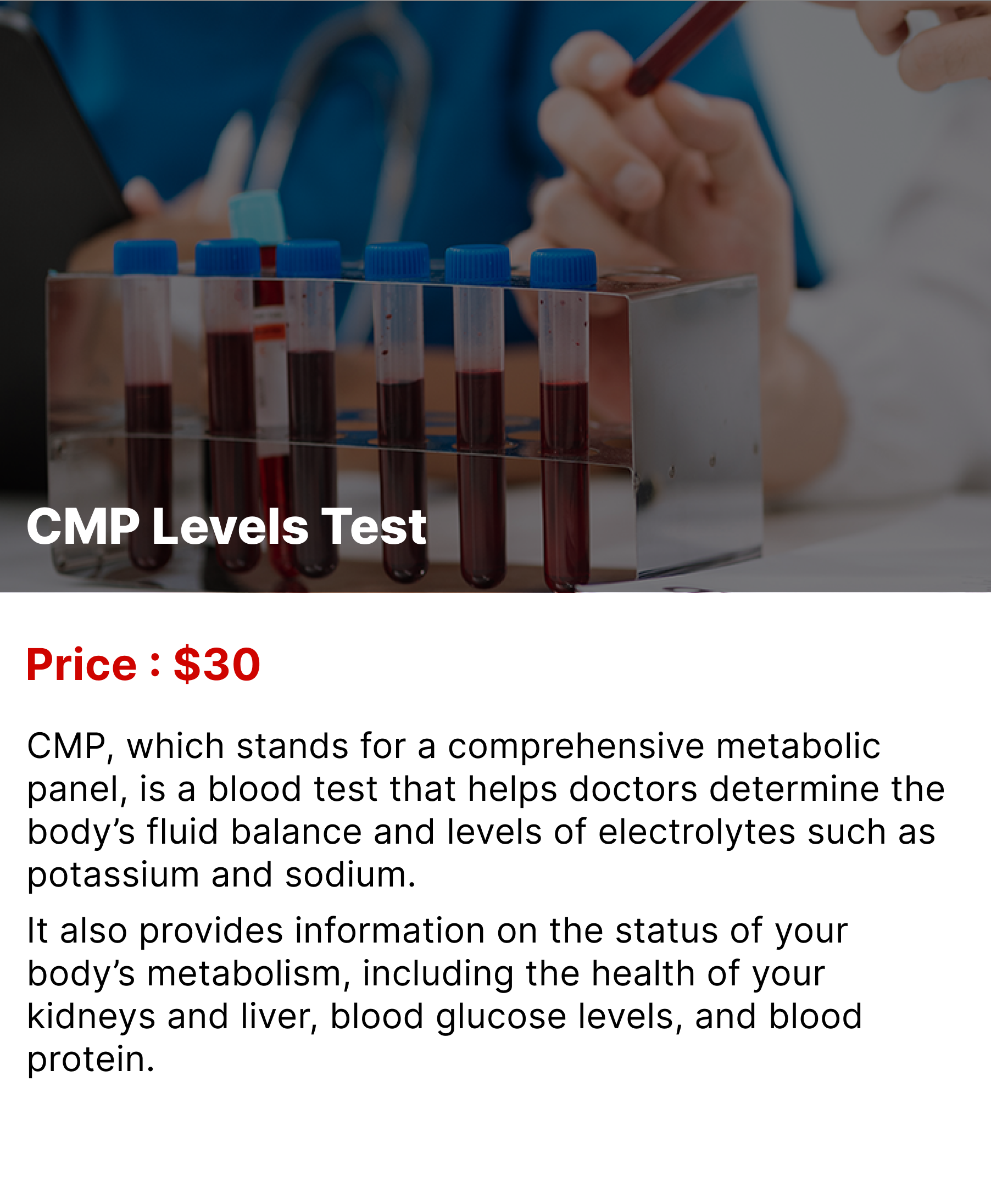 CMP Levels