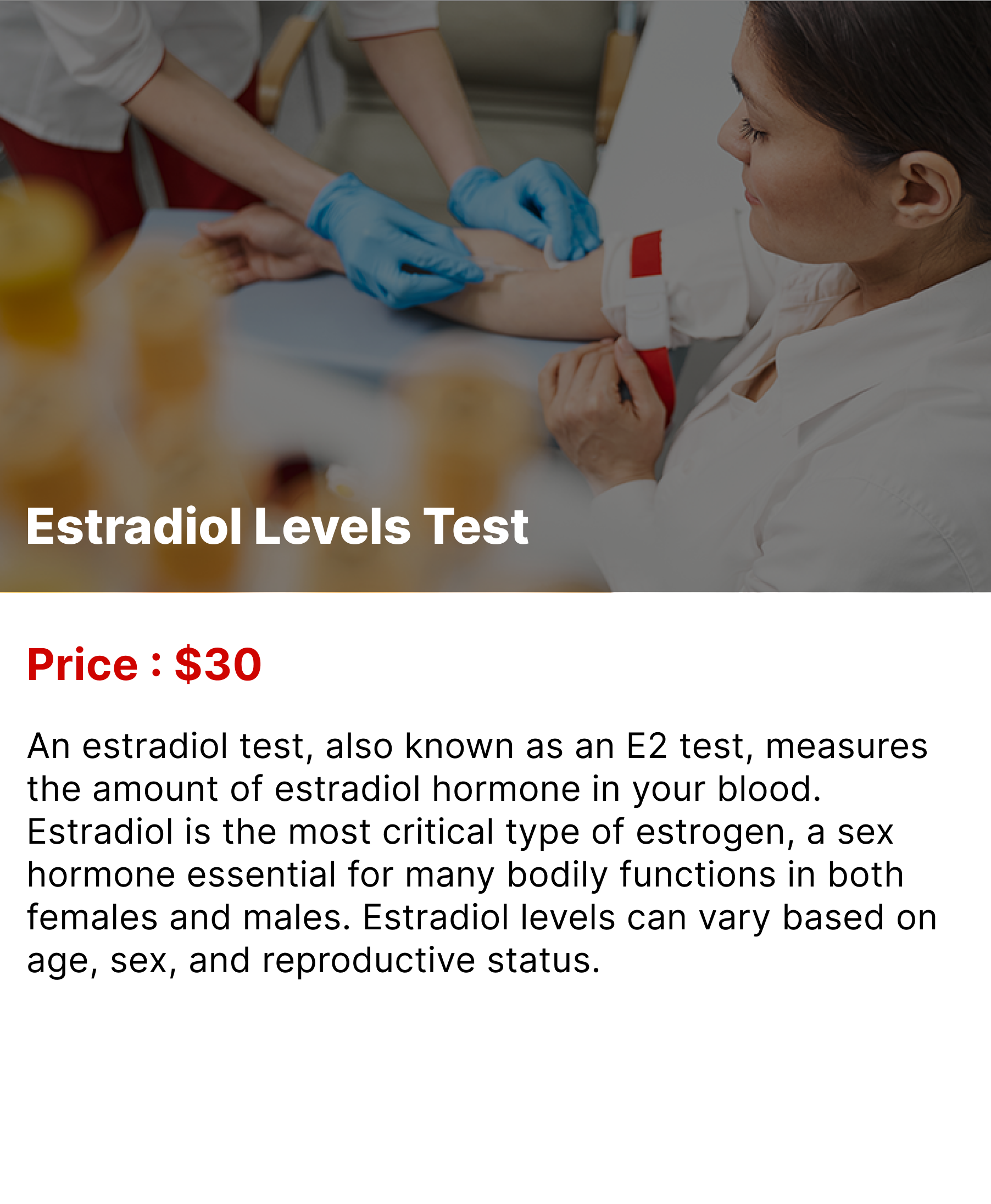 Estradiol Levels